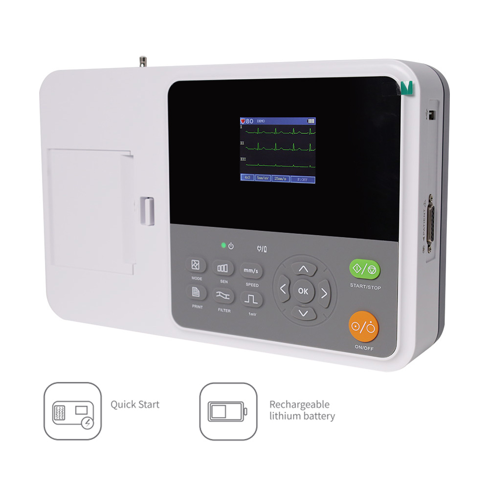 CONTEC E3 Electrocardiógrafo D - Ekg Ecg Machine Portable reseña y precio